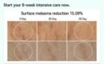 Melasma Treatment for Face Cica Intensive Serum 30ml - Image 3