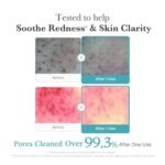 Medicube Azelaic Acid Deep Clean Foam Cleanser 120g - Image 2