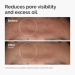 The Ordinary Niacinamide 10% + Zinc 1% Smoothing Serum 30ml - Image 2