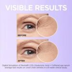 L’Oréal Revitalift Filler Eye Serum – 20ml - Image 2