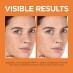 L’Oréal Paris Visage Revitalift Clinical 12% Vitamin C Serum 30ml - Image 2