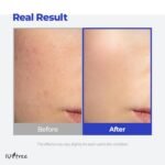 ISNTREE Hyaluronic Acid Aqua Gel Cream – 100ml - Image 2