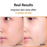 ISNTREE Hyper Vitamin C 23 Serum – 20ml - Image 2