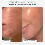 Paula’s Choice SKIN PERFECTING 2% BHA Liquid Exfoliant 30ml - Image 2