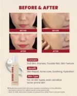 KSecret Seoul 1988 Essence: Snail Mucin 97% + Rice 100ml - Image 2