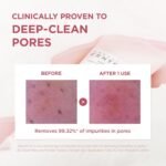 SKIN1004 Poremizing Deep Cleansing Foam – 125ml - Image 2