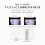 SKIN1004 Niacinamide 10% Boosting Shot Ampoule – 30ml - Image 3