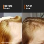 Minimalist Hair Density Serum 18% Hair Fall Control Serum 30ml - Image 2