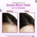 Mamaearth Rosemary Hair Oil with Rosemary & Methi Dana 150ml - Image 2