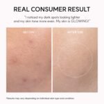 Arencia TXA Booster Shot Serum 30ml - Image 2