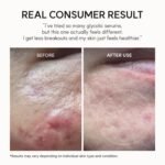 Arencia Eraser Shot Serum Glycolic Acid Booster 30ml - Image 2