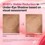 Anua Niacinamide 5+ TXA Brightening Pad 60 Pads - Image 3