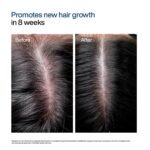 WishCare Hair Growth Serum Concentrate Roll-On 30ml - Image 4