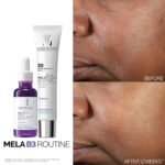 La Roche-Posay Mela B3 Dark Spot Serum 30ml - Image 3